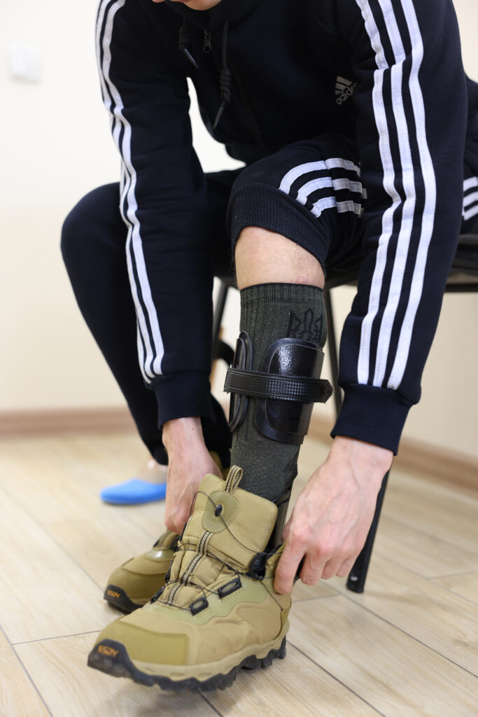Dynamic Strut foot prosthesis: freedom of movement for an active life